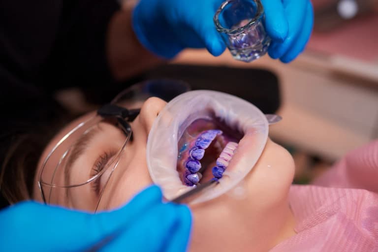Igiene professionale nel bambino: l’air-flow guidato dalla placca può fare la differenza