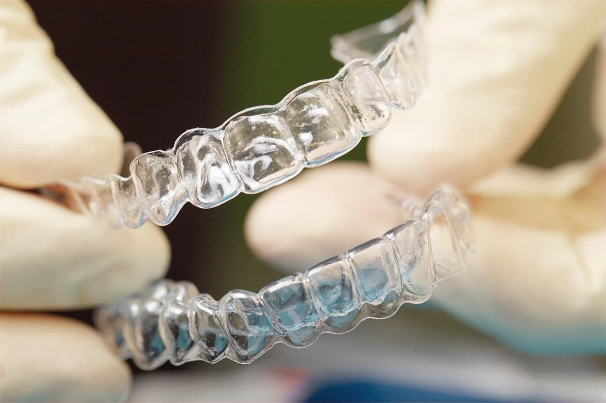 Torque con allineatori trasparenti: il materiale conta più del design